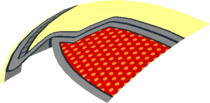 ~Dish  6 x  6 Inverted - No Studs with Handle with Red/Orange Patch and Wires Pattern - 1/2